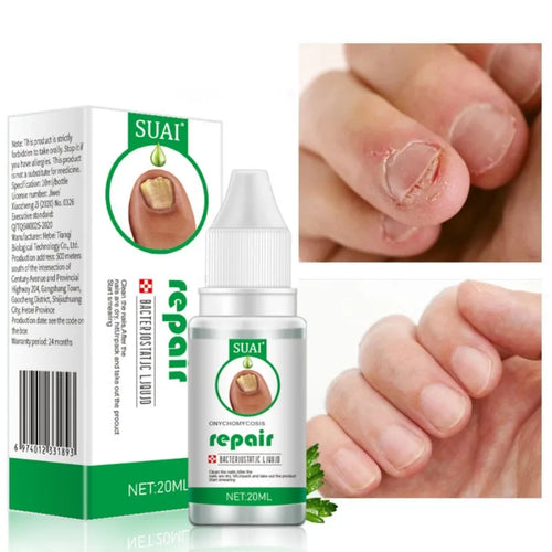 Suai Repair™ - Elimina fungos e restaura unhas danificadas