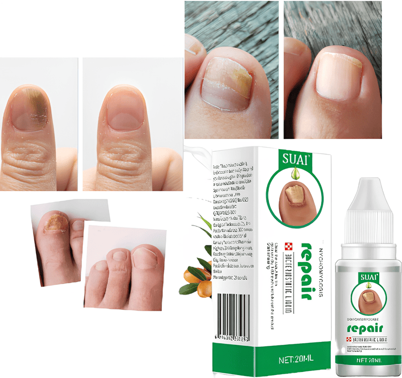 Suai Repair™ - Elimina fungos e restaura unhas danificadas